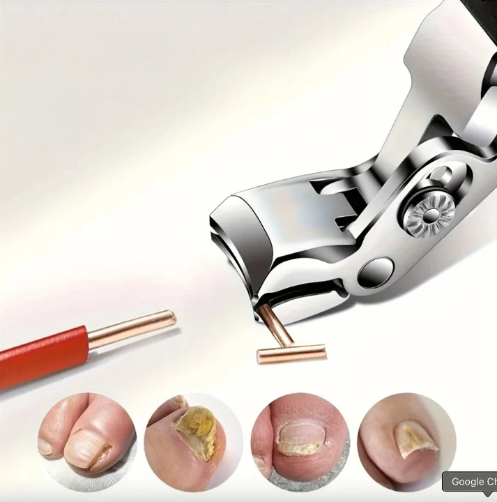 Ensemble de Coupe-ongles pour Ongles Incarnés - 4PCS