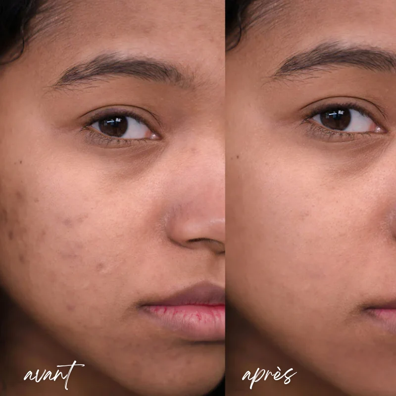 Sérum Visage 5 en 1 : Hyaluronique, Nicotinamide, Vitamine C et E & Collagène